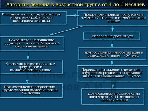 Дисплазия тазобедренных суставов у младенцев