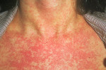 Krasnuxa-4
