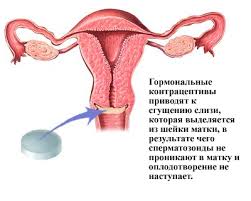блокирование овуляции