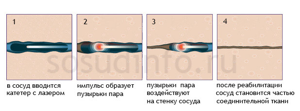 54686848