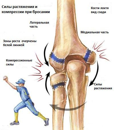 Противоборствующие силы, которые приводят к травме сустава