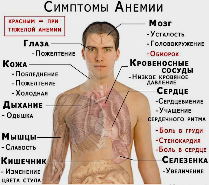Симптомы дефицита железа у человека