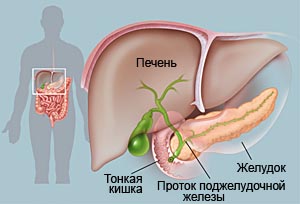заболевания поджелудочной железы