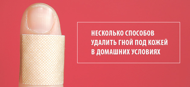 способы убрать гной из пальца на руке