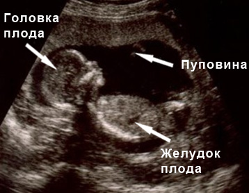 Двадцать шестая неделя беременности