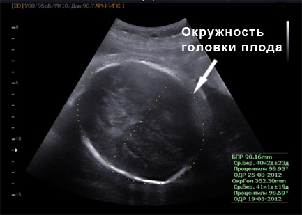 Сороковая неделя беременности