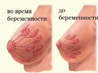 Изменения в груди при беременности