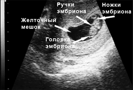 УЗИ на восьмой неделе беременности